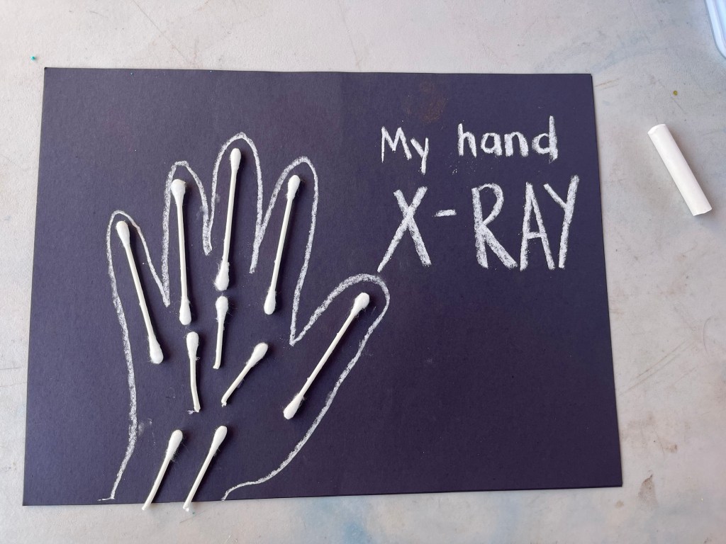 The Human Body: Hand X-Ray&nbsp;Craft